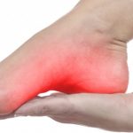 Queimação nos pés e síndrome dos pés ardentes
